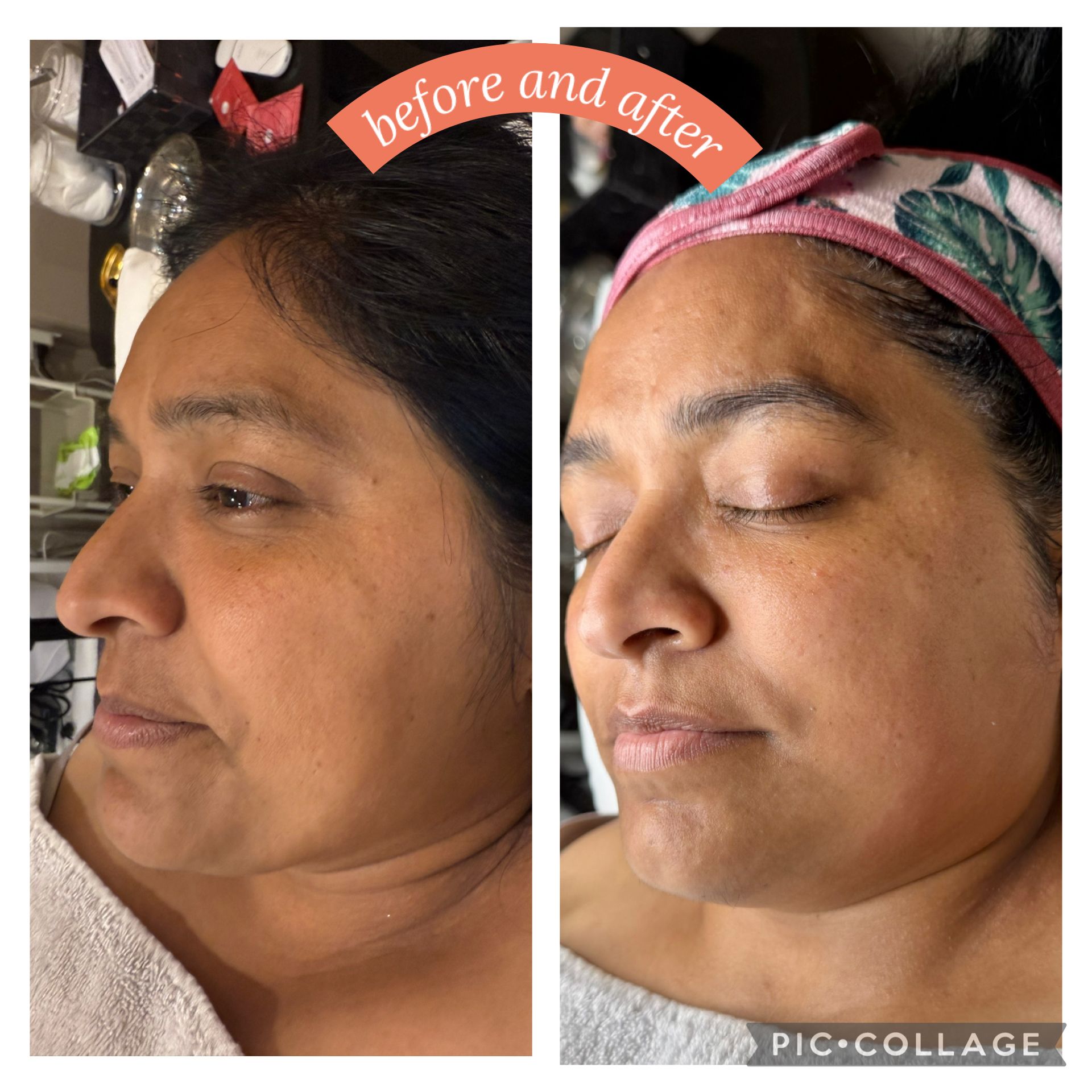 Professional skincare product — serum bottle