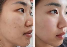 Facial treatment menu